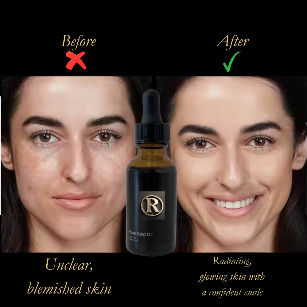 Rosiera™ Rosehip Oil Face Serum